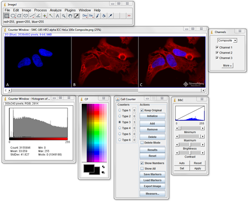 Microscopy Image Processing Tools